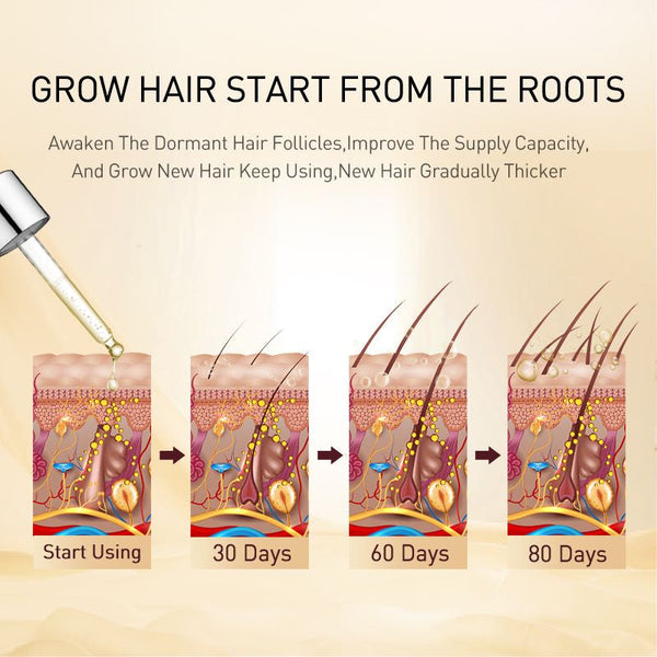 Ginger Hair Growth Products Prevent Hair Loss Essential Oil Fast Growing Scalp Treatment Beauty Health for Men Women